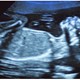 Researchers find soot particles in vital organs of the unborn